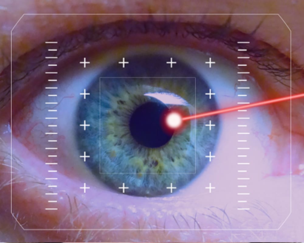 Aplicación laser por retinopatía